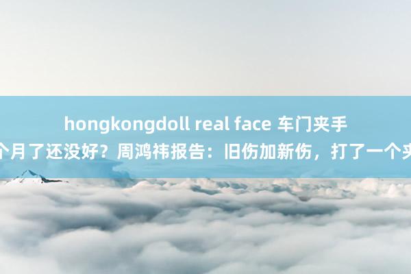 hongkongdoll real face 车门夹手一个月了还没好？周鸿祎报告：旧伤加新伤，打了一个夹板